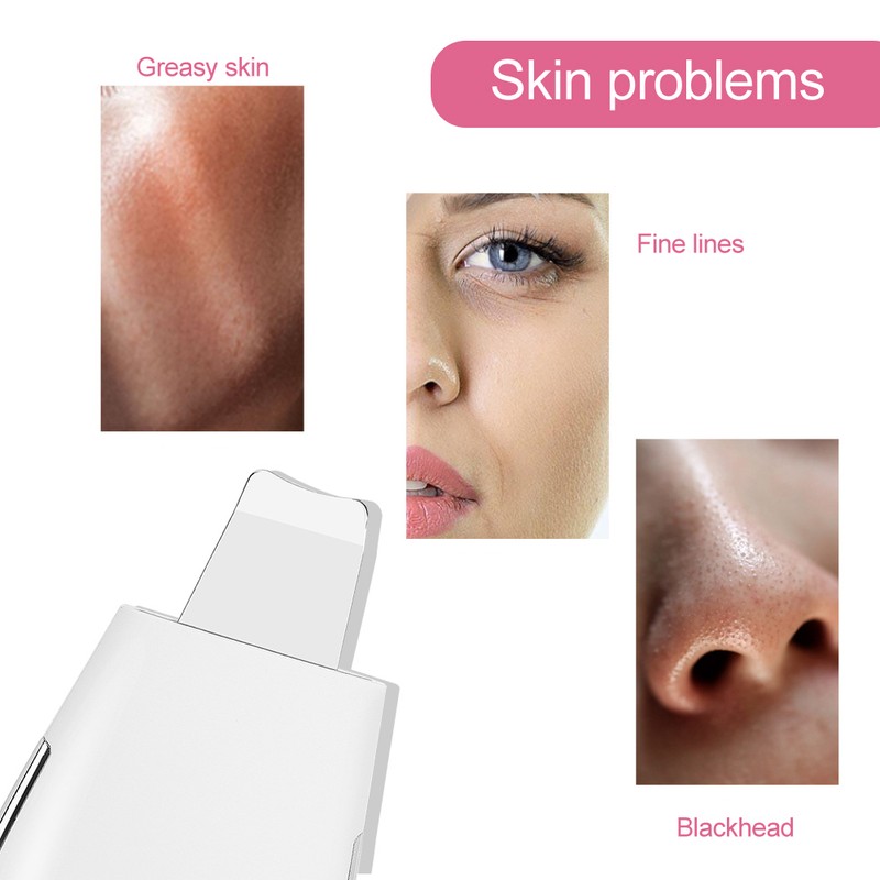 Household Ultrasonic Skin Scrubber EMS MicroCurrent Blackhead Removal Face Pore