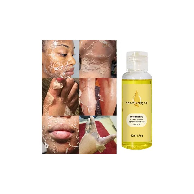 _ Aceite Exfoliante Amarillo Para Pelar, Aceite Exfoliante