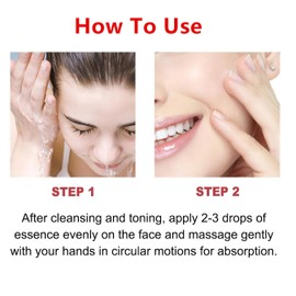 Niacinamide Serum, Dark Spot Correcting Serum, Facial Serum, Brightening Serum, Whitening Serum, Anti-Ageing Face Serum, for Face and Body for Men and Women, 30 ml