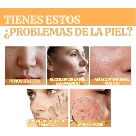 cido Gliclico Exfoliante Anti Mancha Acn Aclarante Codos Momento de aplicacin Noche Tipo de piel Todo tipo de piel                                    