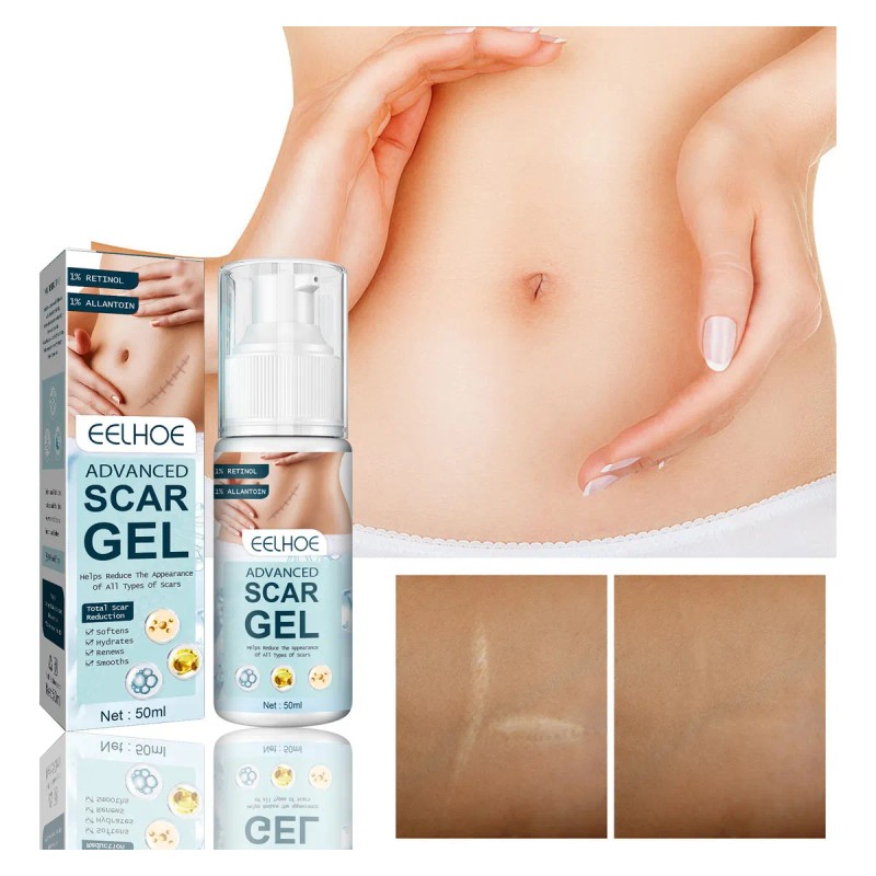 Una Crema Para Eliminar Cicatrices Crema Reparadora De Cicat