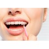 500 Pcs Orthodontic Elastic Rubber Bands, 3.5 Ounces Heavy Dental