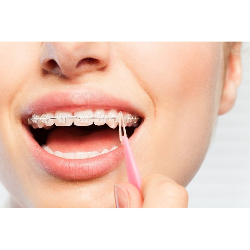 500 Pcs Orthodontic Elastic Rubber Bands, 3.5 Ounces Heavy Dental