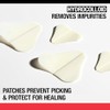 Neutrogena Stubborn Acne Ultra-Thin Blemish Patches, Acne Pimple Patches, Ultra-Thin
