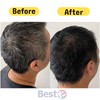 PYEONAN Speed Hair Dye Color Latest New Version Cover White