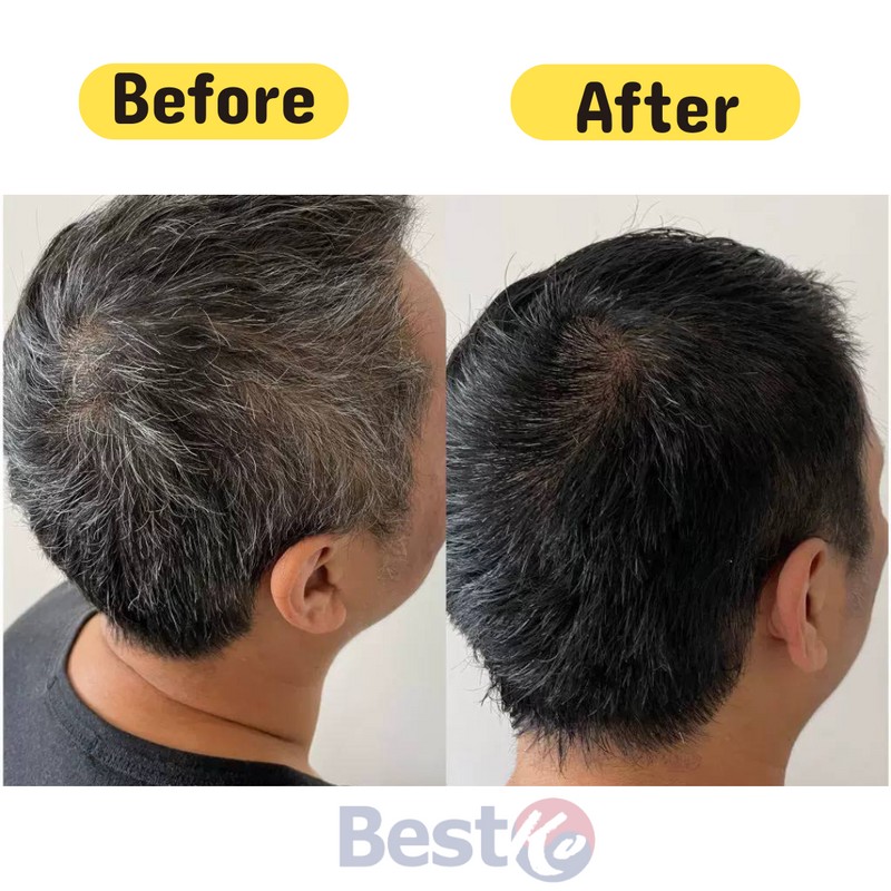 PYEONAN Speed Hair Dye Color Latest New Version Cover White