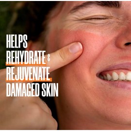 Zax's Original Burn Cream, Natural, Soothing, 6 Natural Ingredients, Heals Minor Burns and Sunburns, Pharmacist Developed, Canadian Made, 28 g