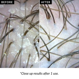 Love Ur Curls Love Ur Curls Exfoliating Scalp Scrub, Moisturizing, Gentle Build Up Removal for Curly Hair - with Peppermint Oil, for Alll Curl Types, 150mL