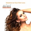 Laser Hair Growth Comb Anti Hair Loss Massager Hair Regrowth