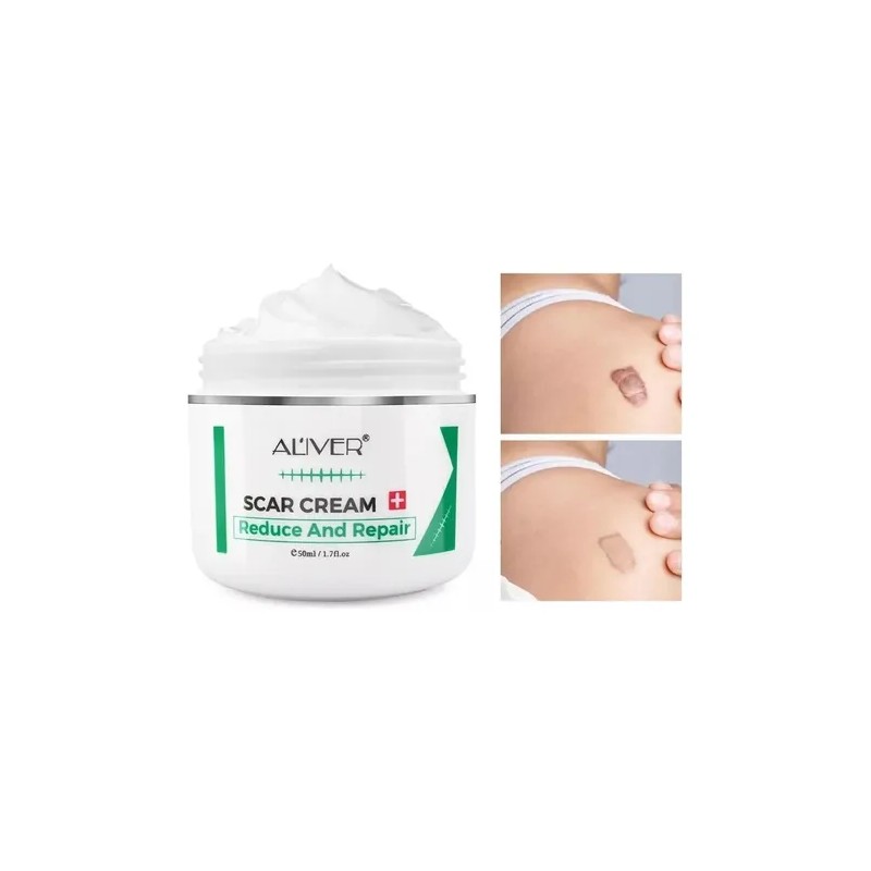 Crema Para Cicatrices, Estrías, Acné, Cacarizos Crema Repara