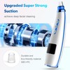 Blackhead Remover Pore Vacuum Upgraded Facial Pore Cleaner Electric Comedone