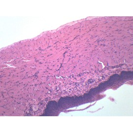 EISCO (Pack of 10) Pseudostratified Columnar Ciliated Epithelium, Prepared Microscope Slides - 75 x 25mm - Classroom Pack, 10 Slides in Storage Case - Biology & Microscopy