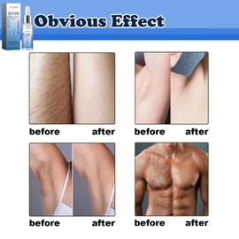 Facial Hair Stop Serum,Facial Hair Natural Treatment at Home,Facial Hair Removal Treatment,Hair Inhibitor Serum,Get Rid of Face Hair,Stick on Facial Hair,Ingrown Hair Treatment,Hair Removal Cream