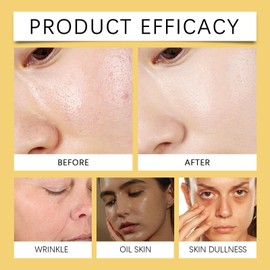 Ear/thly De/rm Turmeric Soap,Ko/jic Acid Turmeric Soap Bar,Tu/rmeric & Ko/jic Acid Soap Bar for Body & Face,Tu/rmeric Glow Soap for Cleasing,Dark Spot Remover for Even Skin Tone,for All Skin Types