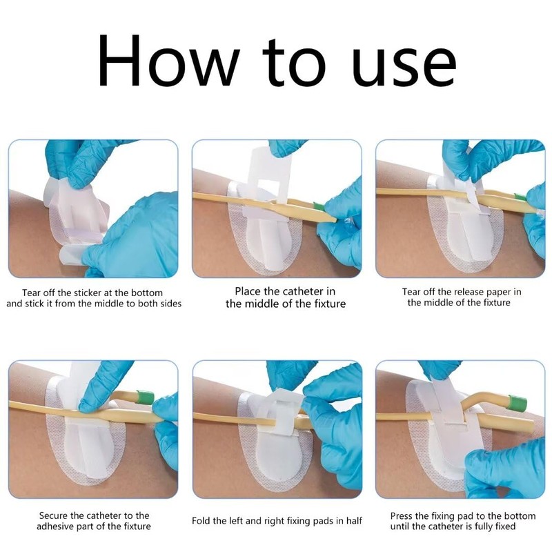 Flosmore 5 Pcs Catheter Stabilization Devices,Catheter Supplies,Foley Catheter Urinary Leg