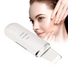 Electric Skin Scrubber Pore Spatula Face Cleaning Blackhead Removal Ultrasound