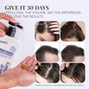 Biotin & Rosemary Shampoo for Hair Growth: Hair Loss Shampoo