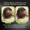Fibras Naturales Cabello Disimular Calvicie Queratina Pelo
