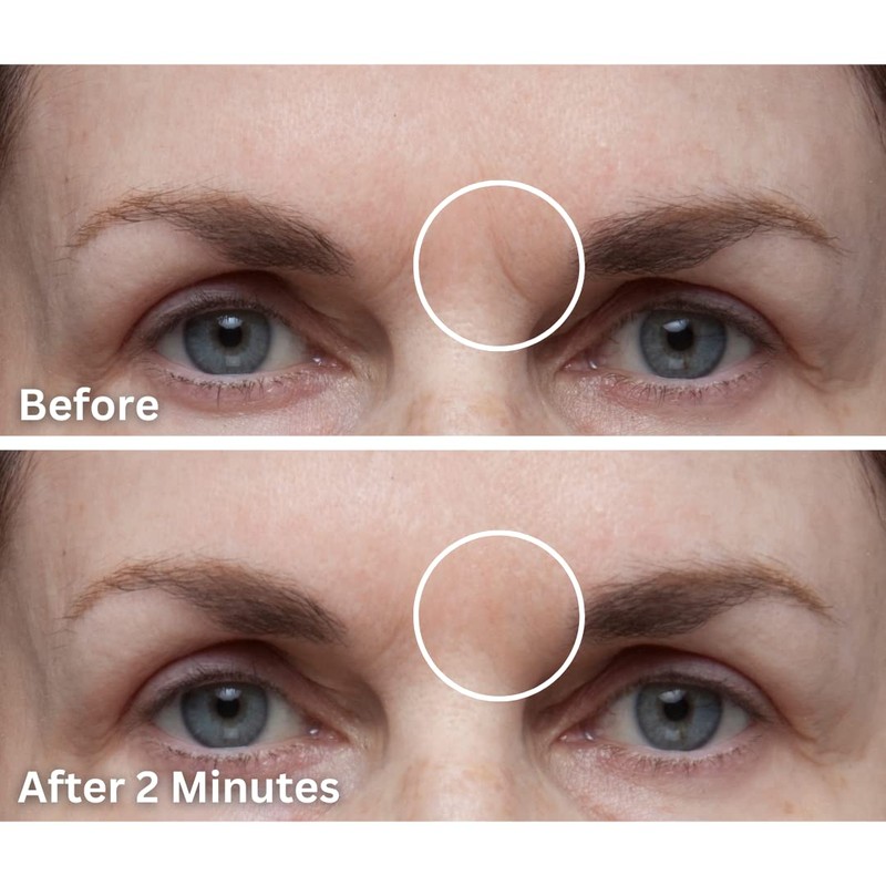 Dermaflage Dermaflage Single Applicator, Scar Concealer Refill (Light)