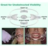 Seemore Cheek Retractor Lip Retractor Tongue Retractor More Views for