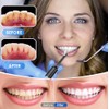 Pulidor de dientes, kit de blanqueamiento dental con 12 accesorios,