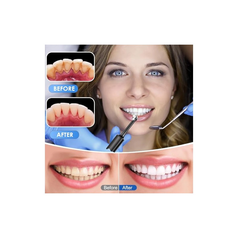 Pulidor de dientes, kit de blanqueamiento dental con 12 accesorios,