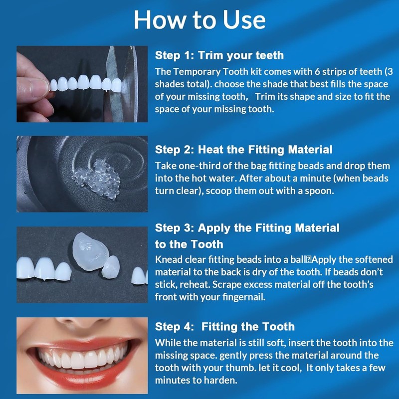 Tooth Repair Kit, Temporary Tooth Replacement Kit, Upper Veneer Cosmetic