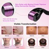 Derma Roller Needles 2.0 mm 540 Titanium Micro Needles for