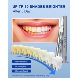 MySmile Teeth Whitening Pen for Sensitive Teeth, 2Pcs Pen For Teeth Whitening, 10 Min Fast Teeth Whitenr, Helps to Remove Stains from Coffee, Smoking, Wines(2Pcs Pen)