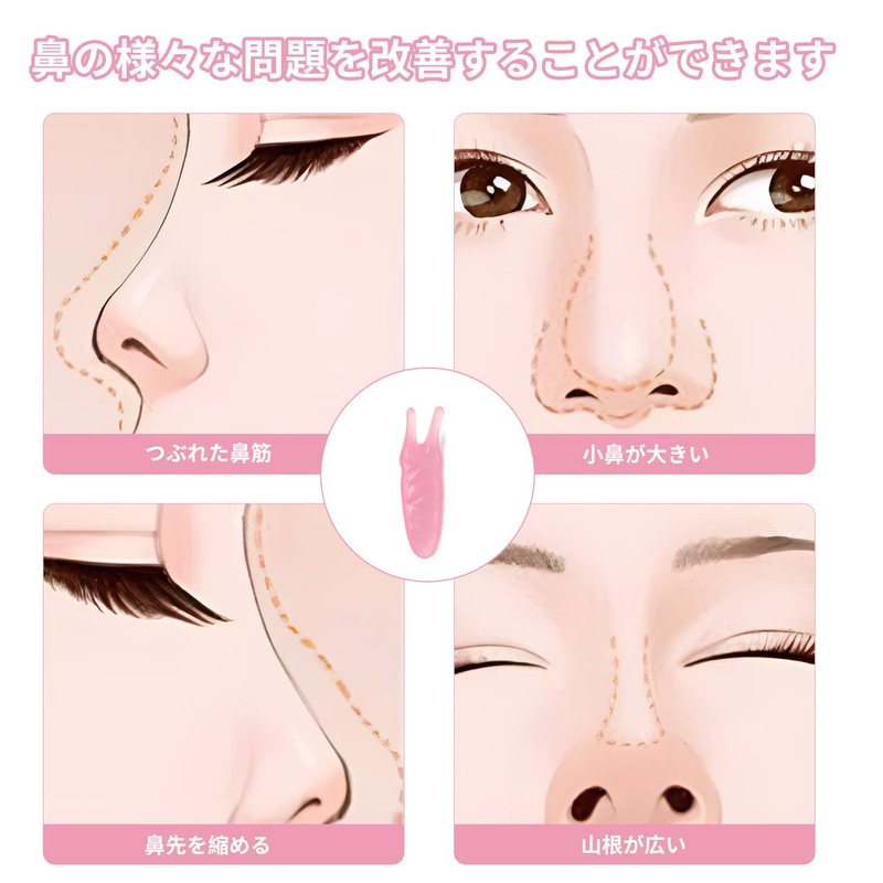 nalaina Plate, Snail Cassa, Nose-raising Goods, Nostrils Improvement, For Faces,