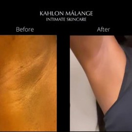 K.M.I Skincare "Try Me First" Rose Clay Armpit Detox Mask 20ml Sample Jar for Sensitive Skin - Odor-Free, Softens Skin, Suitable for All Skin Types - Comfort, Cosmetic, Body Care