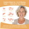 Partial Dentures - Dentures for Missing Teeth & Gaps -