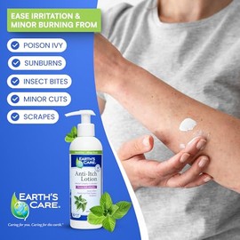 SELPONT Anti Itch Lotion - Steroid Free - Soothes Sunburns, Dry and Itchy Skin, and Minor Skin Irritation, FL. 8 OZ
