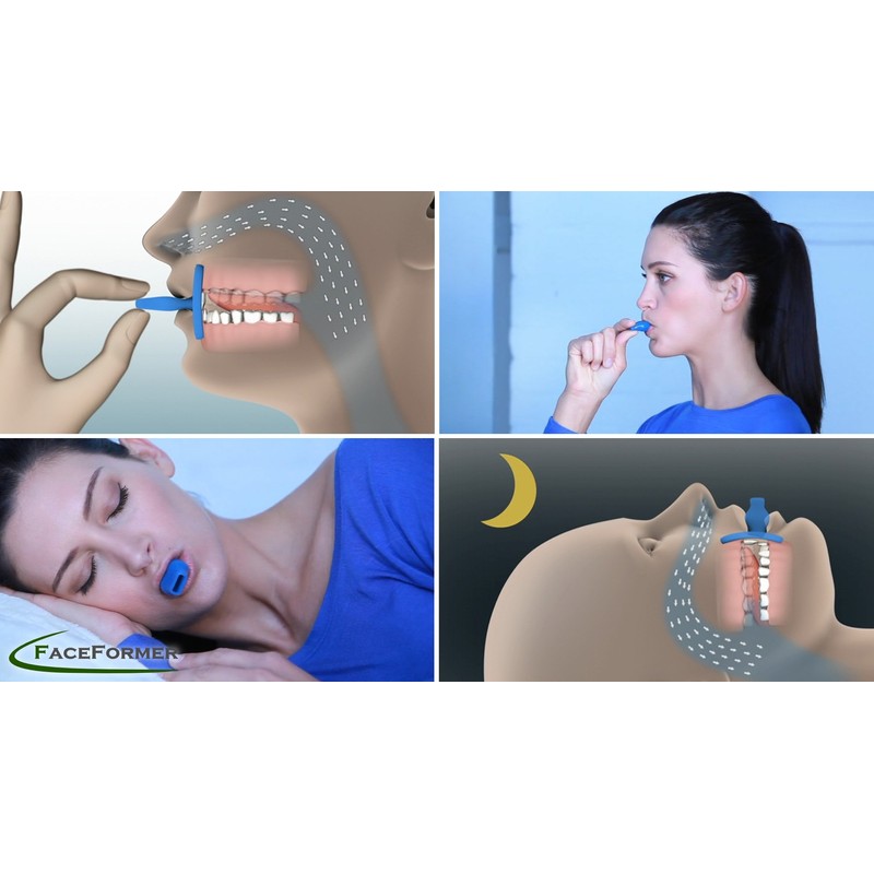 Dr. Berndsen Faceformer Anatomical Blue – Effective against snoring and