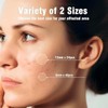 OUKEYA Parches Hidrocoloides Faciales para Imperfecciones, 36 Piezas