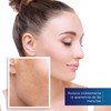 PANALAB Vitanoin Blemish Suero Facial Despigmentante 30 ml