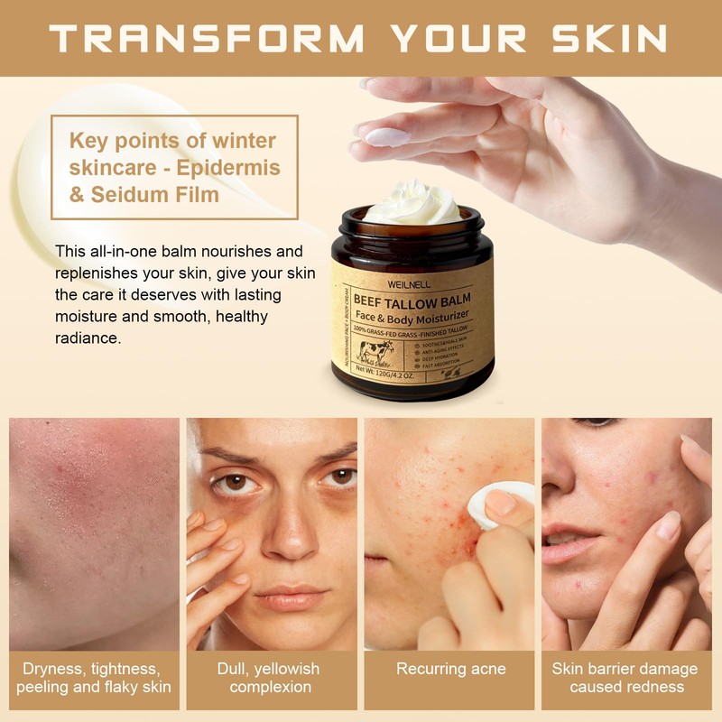 Beef Tallow Cream for Face & Body, Beef Tallow and