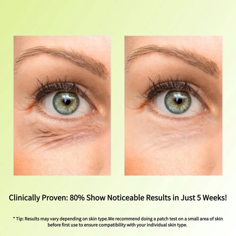 Crema De Ojos Antienvejecimiento Con Retinol 15 Ml Todo .