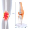 Aribrnten Anatomical Knee Joint with Ligaments Model, Human 1:1 Life