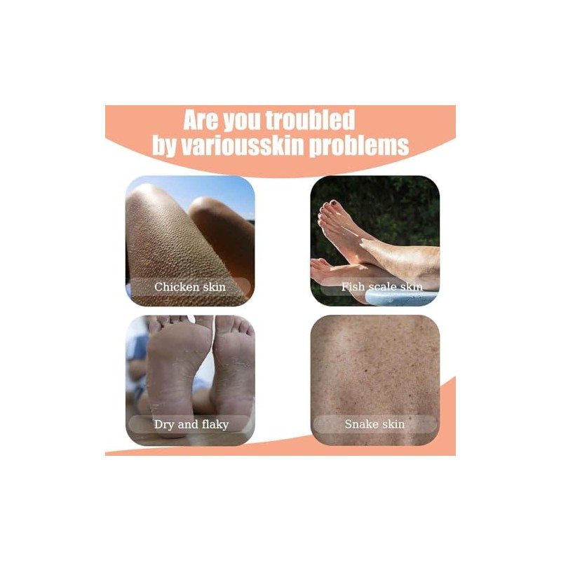 Piezas Crema Rejuvenecedora Piel Fresa Loción Piernas Mujeres Reduce Protuberancias