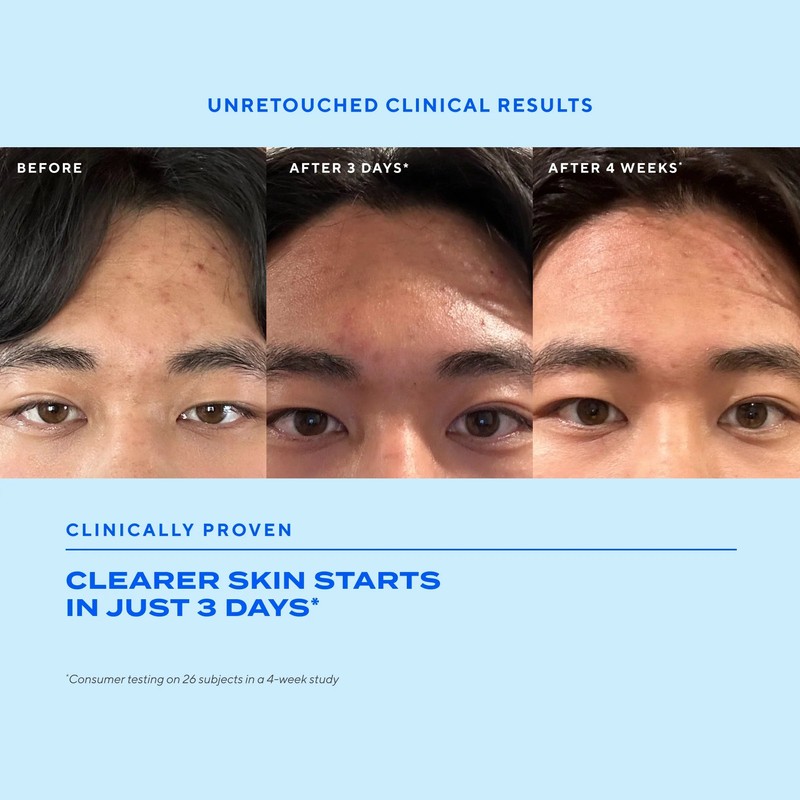 Murad Biome-Balancing Clear & Prevent Blemish Serum 30ml