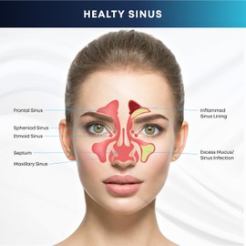 PLUSQMED Sinus Rinse Kit, Neti Pot, Premixed Sachets 40 PCS,Neti Pot 300 ml, Nasal wash