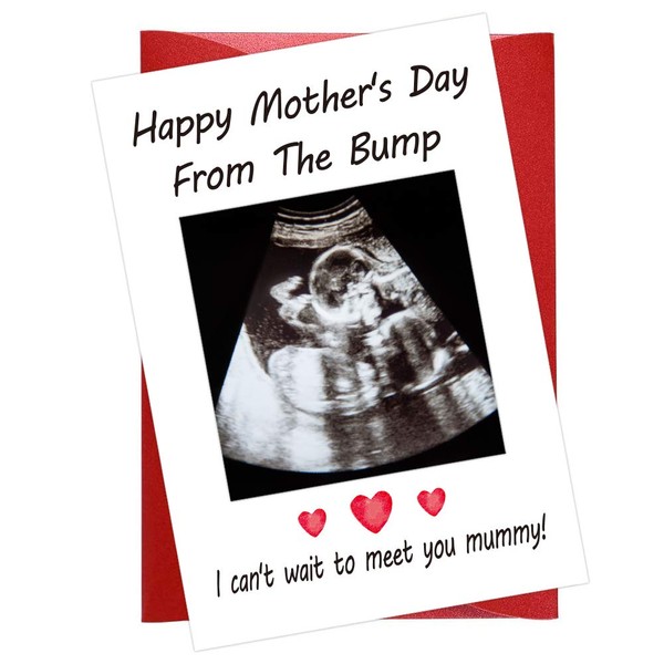 WaaHome Funny First Mothers Day Card for Mom, Mothers Day Card with Photo Insert, 1st Mothers Day Gifts Cards for New Mom,Mommy,Mother to be