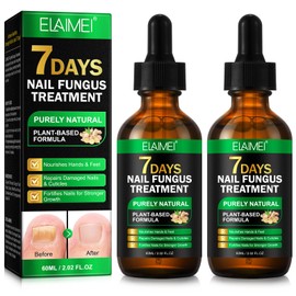 Ginger Nail Treatment, Natural Plant Formula Nail Growth Serum, Ginger Cuticle Care Oil for Strengthen & Promote Nail Growth & Repair Nutrient Oil (2PCS)