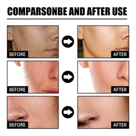 Deep Serum Rice + Alpha-Arbutin,Face Glow Serum,Brightening Serum,Rice Serum,Korean Skincare Serum,Serum For All Skin Types,Korean Face Serum,Face Serum For Women,Best Anti Aging Serum