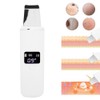 Ultrasonic Face Skin Scrubber Facial Cleanser Exfoliating Remove Blackheads Pimples