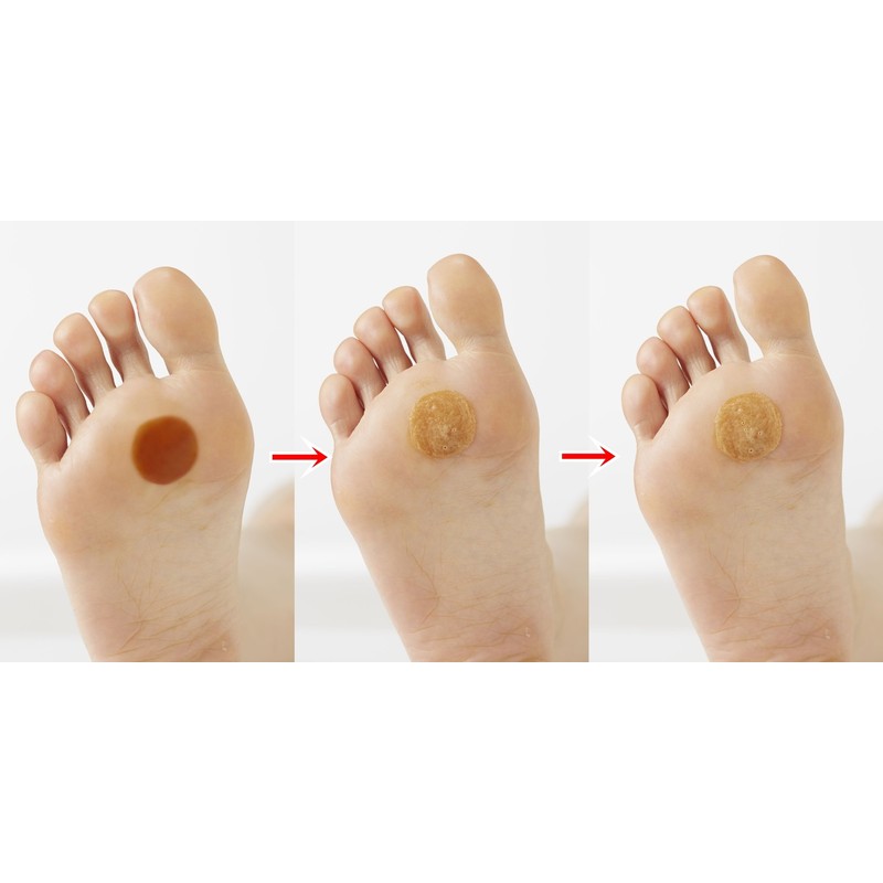 mainorozi ma-mekurin G