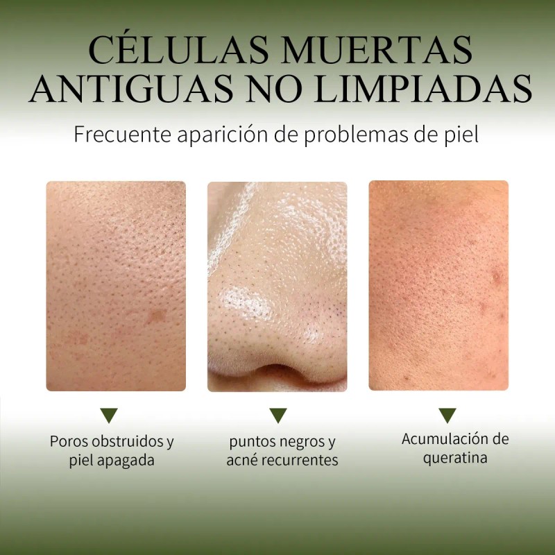 Gel Exfoliante Oxyglow - Elimina Células Muertas En Todo Tipo