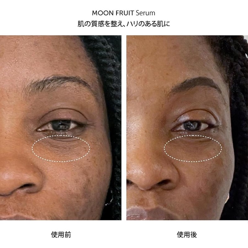 Herbivore Botanicals Moon Fruit Bacticals