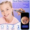 Bebird Pro Ear Wax Removal Tool Camera, Ear Cleaner with Camera, Bebird Note5 10 Megapixel HD Otoscope with Light, Ear Camera with Tweezers 3-in-1, Earwax Removal Kit with Camera for iPhone, Android(White)